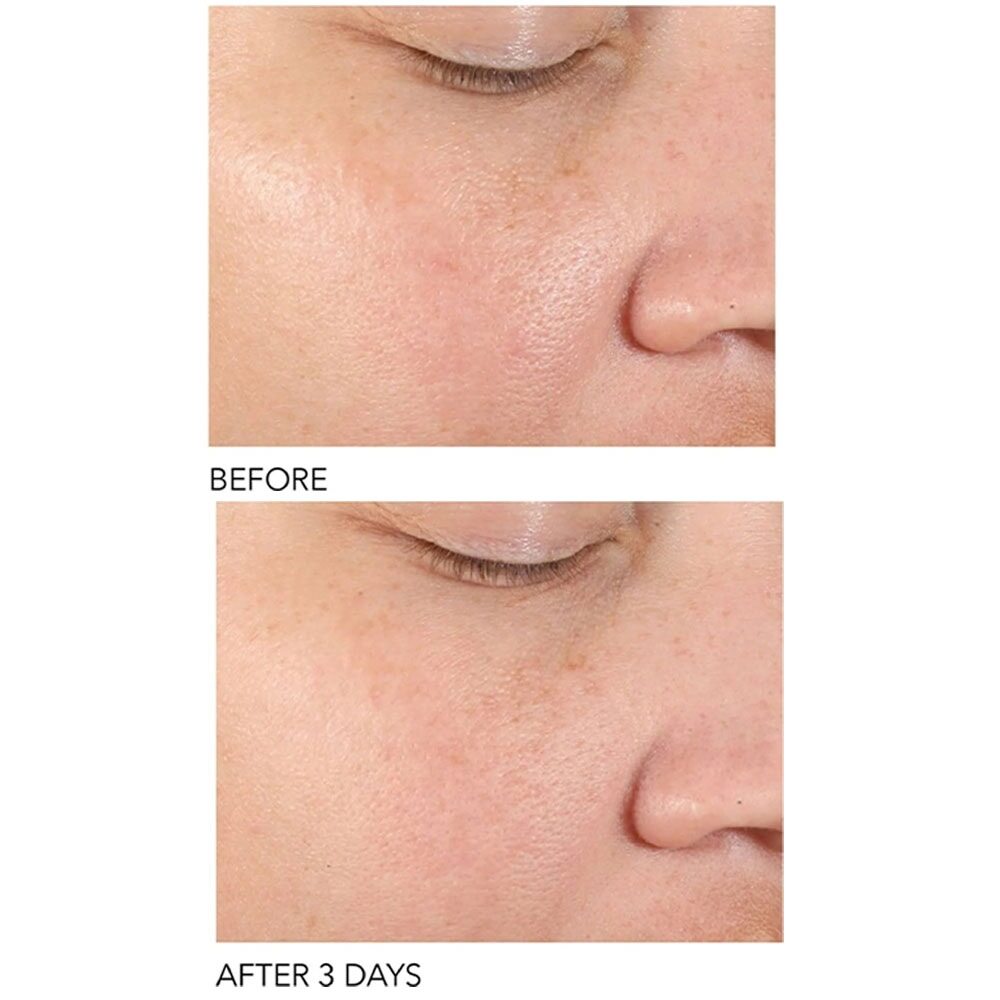 Dr Dennis Gross Alpha Beta Pore Perfecting & Refining Serum 30ml