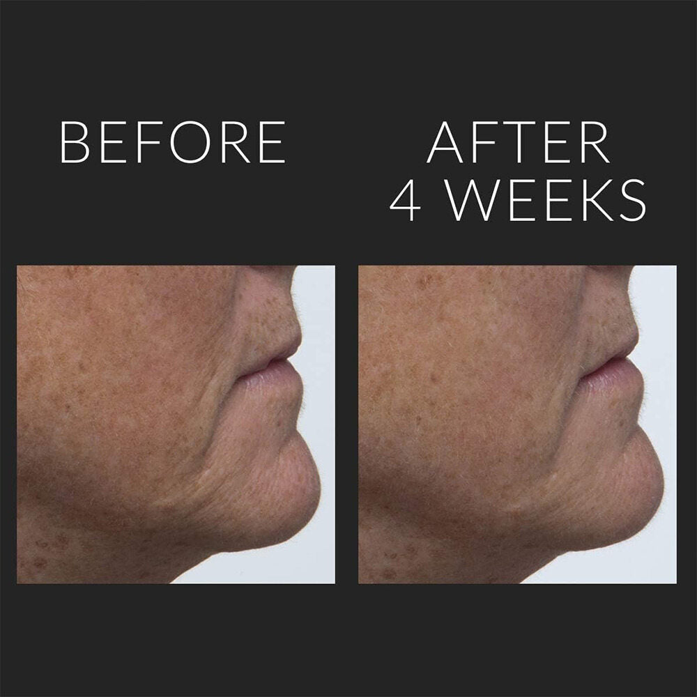 Kate Somerville DermalQuench Liquid Lift + Retinol Advanced Resurfacing Treatment 71g